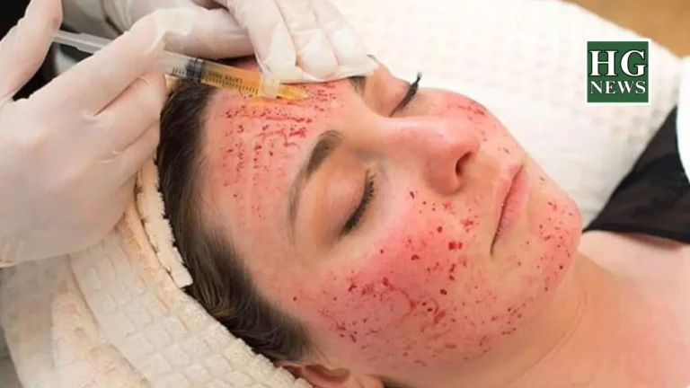 Three infected with HIV from vampire facials